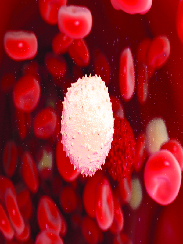 Chronic Lymphocytic Leukemia